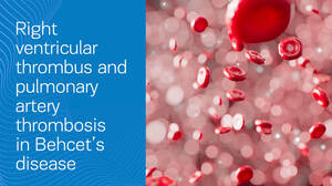 Figure from article: Right ventricular thrombus...